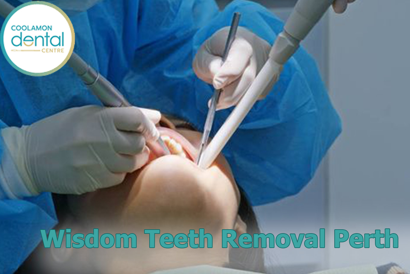 Wisdom Tooth Removal Cost